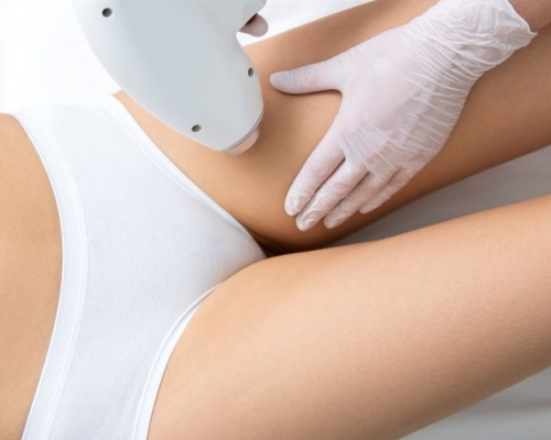 Bikini Laser Hair Removal Mysore